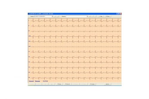 E K G  СОФТУЕР CardioTEKA